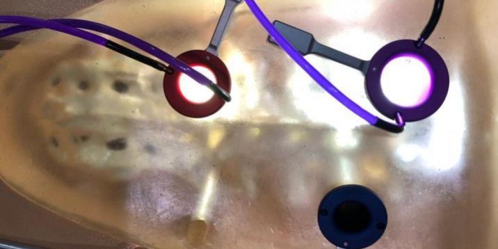 Microdiscectomia Tubular